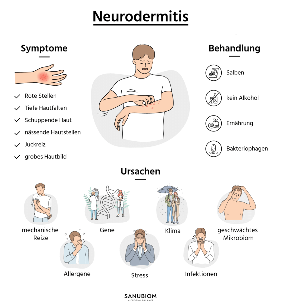 Leitsymptome bei Neurodermitis treten bei Betroffenen verschiedener Altersgruppen in vergleichbarer Form auf